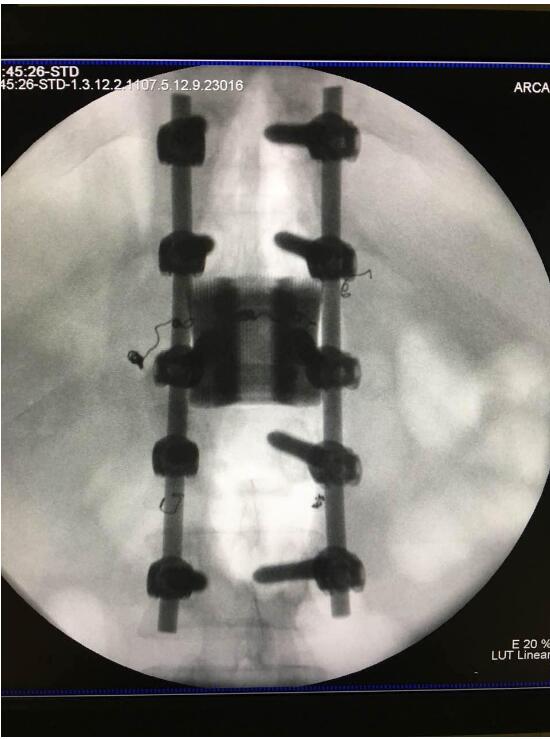 將3D打印引入醫(yī)療，華鈦三維將加快融資腳步-智慧財(cái)經(jīng)網(wǎng)