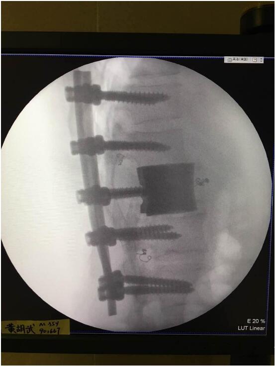 將3D打印引入醫(yī)療，華鈦三維將加快融資腳步-智慧財(cái)經(jīng)網(wǎng)