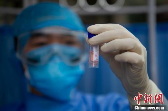 資料圖：3月13日，山西省太原市杏花嶺區(qū)，壩陵橋社區(qū)衛(wèi)生服務中心的醫(yī)療人員查看返崗復工人員咽拭子采樣標本。a target='_blank' href='http://www.chinanews.com/'中新社/a記者 韋亮 攝