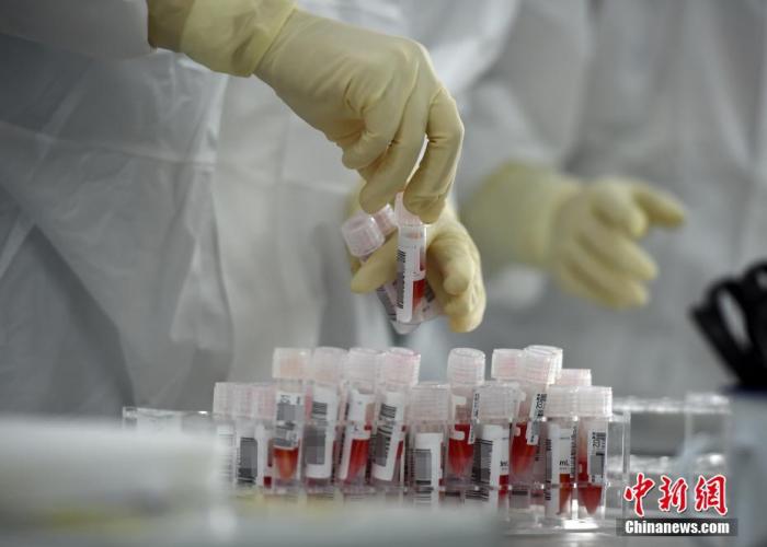 實(shí)驗(yàn)室工作人員整理剛剛送來(lái)的經(jīng)預(yù)處理后的樣本。a target='_blank' href='http://www.chinanews.com/'中新社/a記者 侯宇 攝