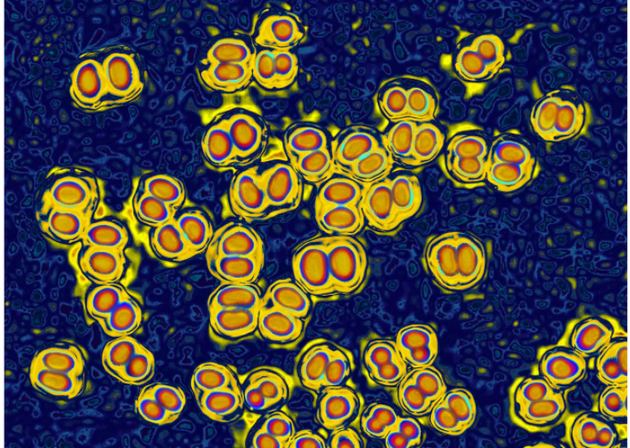 即使接種過疫苗，人體也有可能攜帶某些引起腦膜炎的細菌